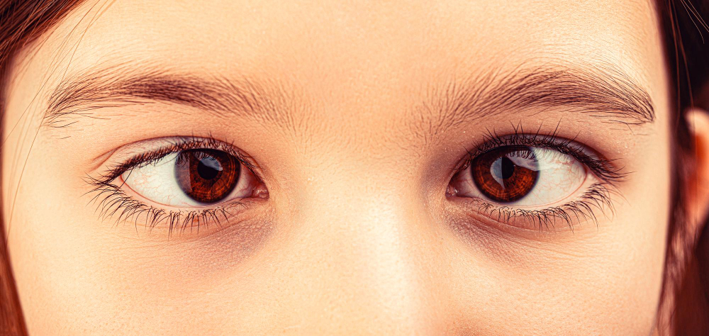 Amblyopia (Lazy Eye)