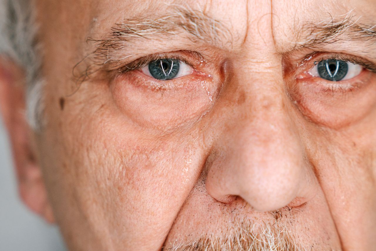 Presbyopia (Aging Eyes)